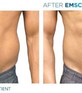 l’esthéticiènne Urban Spa & Beauty es el primer centro de Canarias en contar con la avanzada tecnología estética de EMSculpt · foto 1